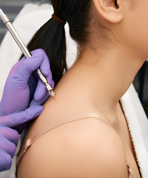 Dermis Clinics